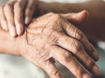 سلول‌های بنیادی به داد بیماران پارکینسونی رسید