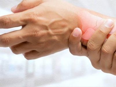 «نانوذرات اگزوزومی» راهی نوین برای درمان آرتریت روماتوئید
